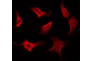 ABIN6268815 staining Hela by IF/ICC. (Caspase 8 Antikörper  (Cleaved-Asp384))