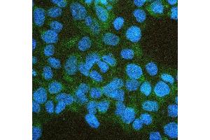 IF analysis of IFNAR2 using anti-IFNAR2 antibody (ABIN7601353).