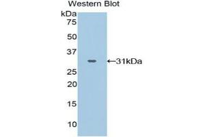 Western blot analysis of the recombinant protein. (GRAP2 Antikörper  (AA 15-247))