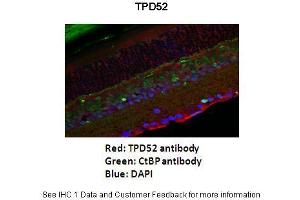 Application: Immunofluorescence Species+tissue/cell type: Mouse retina Primary antibody dilution: 1:200 Secondary antibody: Goat anti-rabbit Alexafluor 568 Secondary antibody dilution: 1:200 - See more at: (TPD52 Antikörper  (Middle Region))