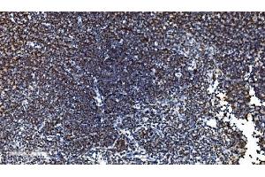 IHC analysis of CDC45L using anti-CDC45L antibody (ABIN7600230). (CDC45 Antikörper  (AA 166-431))