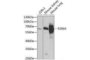 Western blot analysis of extracts of various cell lines using P2RX4 Polyclonal Antibody at dilution of 1:1000. (P2RX4 Antikörper)