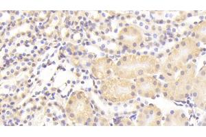 Detection of NUP133 in Mouse Kidney Tissue using Polyclonal Antibody to Nucleoporin 133 (NUP133) (NUP133 Antikörper  (AA 36-240))