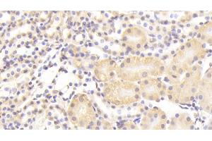 Detection of NUP133 in Mouse Kidney Tissue using Polyclonal Antibody to Nucleoporin 133 (NUP133)