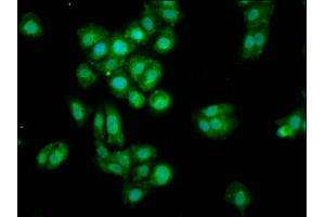 Immunofluorescence staining of HepG2 cells with ABIN7159817 at 1:100, counter-stained with DAPI. (OGN Antikörper  (AA 21-298))