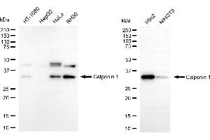 Western blotting analysis using calponin 1 antibody (ABIN7797851). (Rekombinanter CNN1 Antikörper)