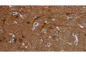 Immunohistochemistry of paraffin-embedded Human brain tissue using PCDHB15 Polyclonal Antibody at dilution 1:50 (PCDHB15 Antikörper)