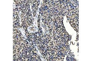 IHC analysis of MTA2 using anti-MTA2 antibody (ABIN7599519).