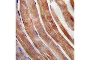 KEAP1 antibody immunohistochemistry analysis in formalin fixed and paraffin embedded human skeletal muscle. (KEAP1 Antikörper  (AA 422-449))