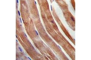 KEAP1 antibody immunohistochemistry analysis in formalin fixed and paraffin embedded human skeletal muscle.