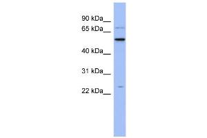 WB Suggested Anti-ZCRB1 Antibody Titration:  0. (ZCRB1 Antikörper  (N-Term))