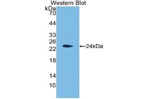 Western Blotting (WB) image for anti-Aggrecan (ACAN) (AA 2163-2316) antibody (ABIN1175194) (Aggrecan Antikörper  (AA 2163-2316))