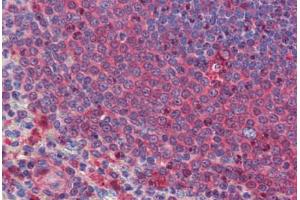 Human Spleen: Formalin-Fixed, Paraffin-Embedded (FFPE) (DACT2 Antikörper  (N-Term))