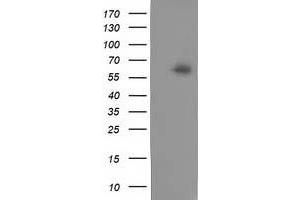 Western Blotting (WB) image for anti-Calcium Binding and Coiled-Coil Domain 2 (CALCOCO2) antibody (ABIN1497076) (CALCOCO2 Antikörper)