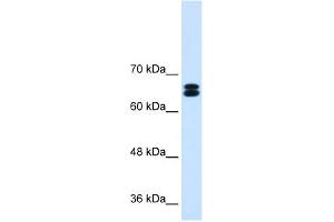 WB Suggested Anti-SLC9A9 Antibody Titration:  0. (SLC9A9 Antikörper  (C-Term))