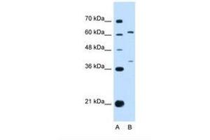 Image no. 1 for anti-Interleukin 28 Receptor, alpha (Interferon, lambda Receptor) (IL28RA) (AA 51-100) antibody (ABIN6749738) (IL28RA Antikörper  (AA 51-100))