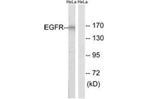 Western Blotting (WB) image for anti-Epidermal Growth Factor Receptor (EGFR) (AA 991-1040) antibody (ABIN2889085) (EGFR Antikörper  (AA 991-1040))