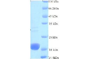 SDS-PAGE (SDS) image for Niemann-Pick Disease, Type C2 (NPC2) (AA 22-149), (full length) protein (His tag) (ABIN7479376)