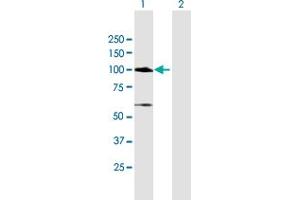 Western Blotting (WB) image for anti-Mutated in Colorectal Cancers (MCC) (AA 1-829) antibody (ABIN517769)