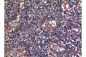 Immunohistochemistry (IHC) analysis of paraffin-embedded Human Lymph Gland, antibody was diluted at 1:100. (Cytokeratin 19 Antikörper  (C-Term))