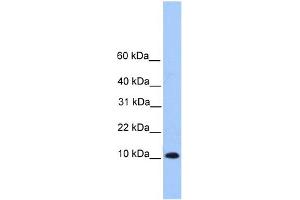 WB Suggested Anti-TRAPPC6B Antibody Titration: 0.