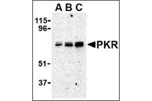 Western blot analysis of PKR in A431 whole cell lysate with this product at (A) 0. (EIF2AK2 Antikörper  (C-Term))