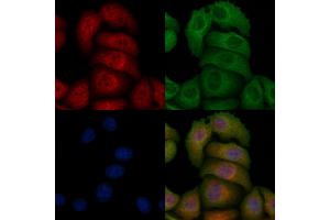 ABIN6256529 and ABIN6267184 staining heat-shock treated Hela cells by IF/ICC. (SQSTM1 Antikörper  (pSer272, pThr269))