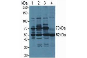 Western blot analysis of (1) Human 293T cells, (2) Human HeLa cells, (3) Human HepG2 cells and (4) Human Saliva Tissue. (PSMC3 Antikörper  (AA 2-439))