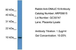 WB Suggested Anti-DNAJC19  Antibody Titration: 0. (DNAJC19 Antikörper  (C-Term))