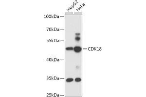 Western blot analysis of extracts of various cell lines, using CDK18 antibody (ABIN7266581) at 1:1000 dilution. (CDK18 Antikörper  (AA 373-474))