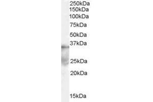 Western Blotting (WB) image for anti-Autophagy related 4A Cysteine Peptidase (ATG4A) (Middle Region) antibody (ABIN2787881) (ATG4A Antikörper  (Middle Region))