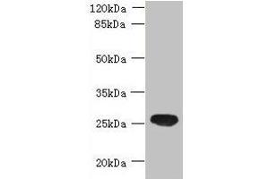 Western blot All lanes: ENKD1 antibody at 7 μg/mL + Mouse brain tissue Secondary Goat polyclonal to rabbit IgG at 1/10000 dilution Predicted band size: 39, 26 kDa Observed band size: 26 kDa (ENKD1 Antikörper  (AA 1-346))