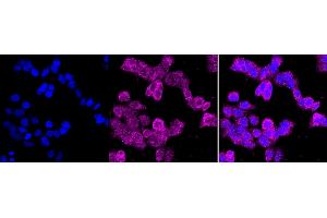 Immunocytochemical staining of HAP-1 cells with CD10 antibody (ABIN7799366), 1:1,000).