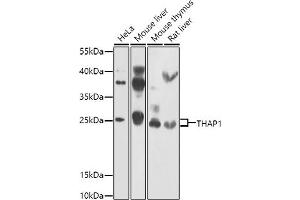 Western blot analysis of extracts of various cell lines, using TH antibody (ABIN6128823, ABIN6149105, ABIN6149106 and ABIN6223361) at 1:1000 dilution. (THAP1 Antikörper  (AA 1-213))