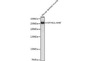Western blot analysis of extracts of Mouse skeletal muscle, using MYH6/α-MHC Rabbit pAb (ABIN6129610, ABIN6144236, ABIN6144237 and ABIN6216792) at 1:3000 dilution.