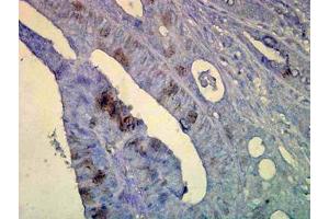 Image no. 1 for anti-Heat Shock Protein 70 (HSP70) (AA 436-503) antibody (ABIN466875) (HSP70 Antikörper  (AA 436-503))