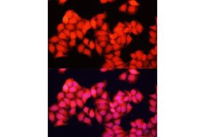 Immunofluorescence analysis of HeLa cells using ARAF antibody  at dilution of 1:100. (ARAF Antikörper  (AA 371-606))