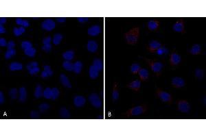 Immunocytochemistry/Immunofluorescence analysis using Mouse Anti-VPS35 Monoclonal Antibody, Clone 10A8 (ABIN6932981). (VPS35 Antikörper  (Atto 390))