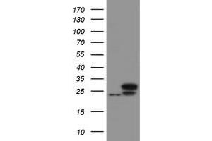 Image no. 1 for anti-Ubiquitin-Conjugating Enzyme E2E 3 (UBE2E3) antibody (ABIN1501625) (UBE2E3 Antikörper)