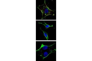 Fluorescent confocal image of an SY5Y (SH-SY5Y, ATCCCRL-2266) cell stained with (ABIN1882197 and ABIN2843885) KIT antibody.