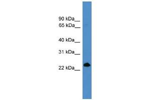 WB Suggested Anti-TNFSF4 Antibody Titration: 0. (TNFSF4 Antikörper  (Middle Region))