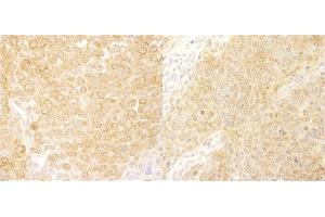 Immunohistochemistry (IHC) image for anti-Breast Cancer Anti-Estrogen Resistance 1 (BCAR1) (AA 275-325) antibody (ABIN7453662)
