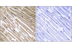 Immunohistochemistry analysis of paraffin-embedded human heart tissue, using NDRG4 Antibody. (NDRG4 Antikörper  (AA 187-236))