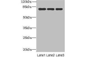 Western blot All lanes: Xaa-Pro aminopeptidase 1 antibody at 8 μg/mL Lane 1: Mouse small intestine tissue Lane 2: Mouse stomach tissue Lane 3: Mouse kidney tissue Secondary Goat polyclonal to rabbit IgG at 1/10000 dilution Predicted band size: 70, 68, 75, 73 kDa Observed band size: 70 kDa (XPNPEP1 Antikörper  (AA 2-623))