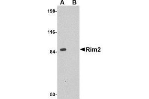 Western Blotting (WB) image for anti-Regulating Synaptic Membrane Exocytosis 2 (RIMS2) (Middle Region) antibody (ABIN1031067) (RIMS2 Antikörper  (Middle Region))