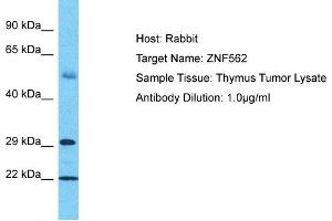 Host: Rabbit Target Name: ZNF562 Sample Tissue: Human Thymus Tumor Antibody Dilution: 1ug/ml (ZNF562 Antikörper  (C-Term))