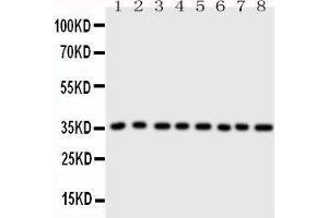 Western Blotting (WB) image for anti-Annexin A3 (ANXA3) (AA 124-141), (Middle Region) antibody (ABIN3043176) (Annexin A3 Antikörper  (Middle Region))