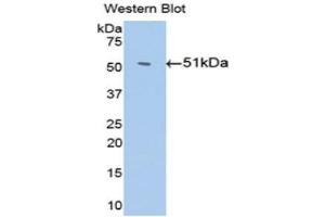 Western Blotting (WB) image for anti-Serpin Family C Member 1 (SERPINC1) (AA 159-258) antibody (ABIN3201708) (SERPINC1 Antikörper  (AA 159-258))