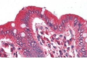 Human Colon (formalin-fixed, paraffin-embedded) stained with SLC5A1 antibody ABIN364451 at 5 ug/ml followed by biotinylated goat anti-rabbit IgG secondary antibody ABIN481713, alkaline phosphatase-streptavidin and chromogen. (SLC5A1 Antikörper)