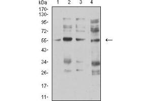 Western blot analysis using CHRNA5 mouse mAb against membrane protein lysate of C6 (1), membrane protein lysate of SK-N-SH (2), membrane protein lysate of C6 (3), and C6 (4) cell lysate. (CHRNA5 Antikörper  (AA 23-254))